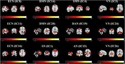 Altered static functional network connectivity predicts the efficacy of non-steroidal anti-inflammatory drugs in migraineurs without aura